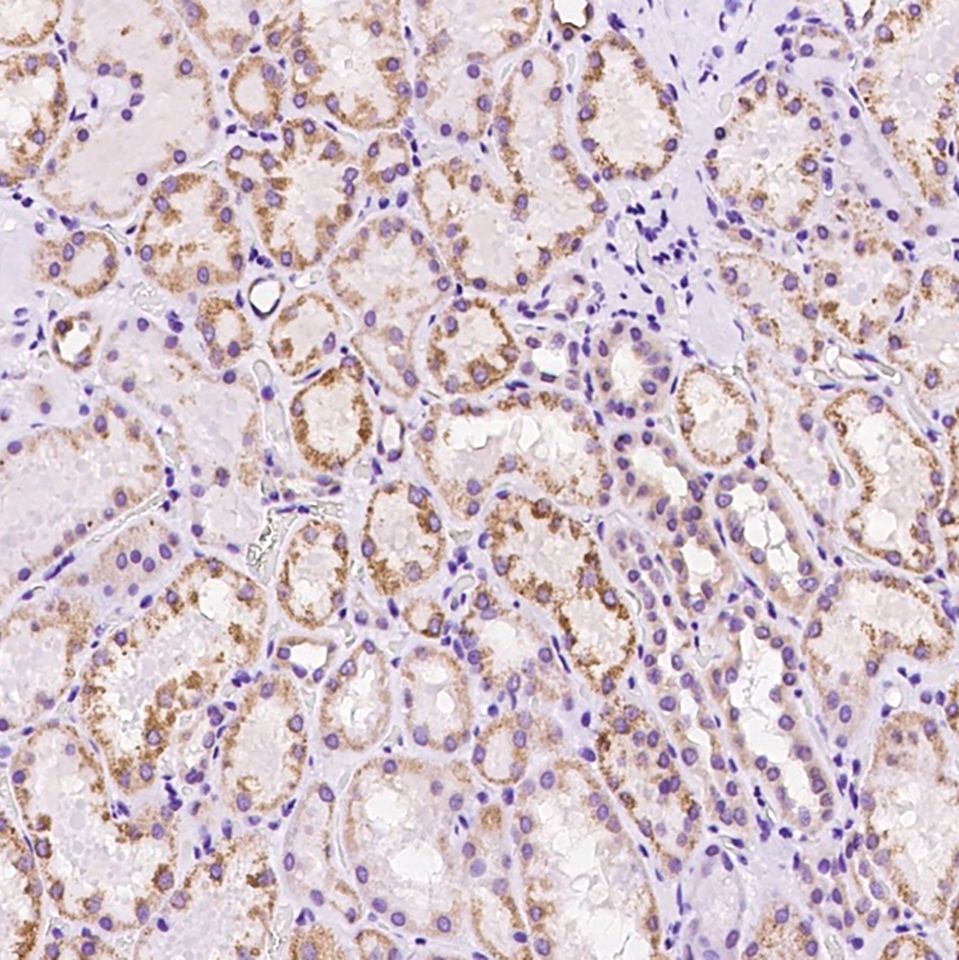 ALDH2 兔多抗 (抗原亲和纯化)