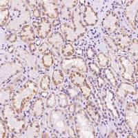 ALDH2 兔多抗 (抗原亲和纯化)