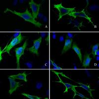 Anti-S-tag Antibody, Rabbit Pab, Antigen Affinity Purified | 抗 S-tag 兔多抗 (抗原亲和纯化)