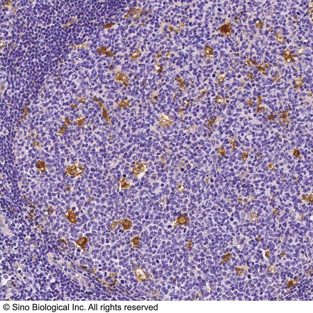 GLUL 兔多抗 (抗原亲和纯化)