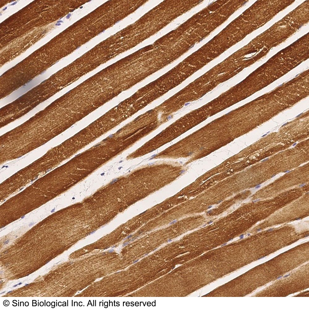 Sino Biological ACO2 / Aconitase 2 兔多抗 WB/ELISA/IHC-P/IP应用 抗原亲和纯化