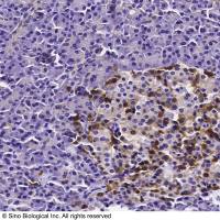 Chromogranin A 兔多抗 (抗原亲和纯化)