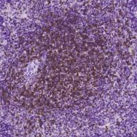 CD3 epsilon / CD3e, Rabbit PAb | CD3 epsilon / CD3e 兔多抗