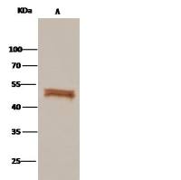 SerpinF1 / PEDF 兔多抗 (抗原亲和纯化)