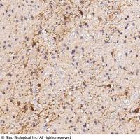 CAMKV 兔多抗 (抗原亲和纯化)