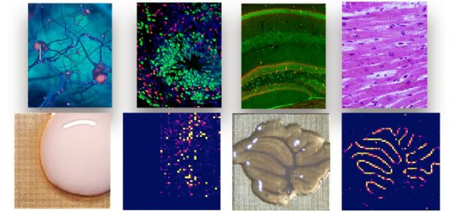 3Brain公司旗下的HyperCAM Alpha-电生理功能成像新前沿
