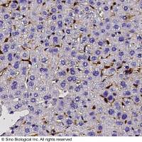 CD5L / Aim Antibody, Rabbit PAb, Antigen Affinity Purified | CD5L / Aim 兔多抗 (抗原亲和纯化)