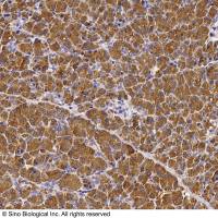 CTRC / chymotrypsin C 兔多抗