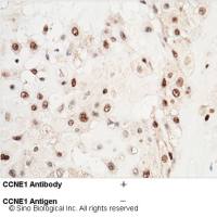 CCNE1 / Cyclin-E1 Antibody, Rabbit PAb, Antigen Affinity Purified | CCNE1 / Cyclin-E1 兔多抗 (抗原亲和纯化)