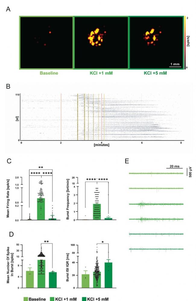 3Brain高分辨3D电极革新急性脑片、脑类器官及神经小球电生理记录