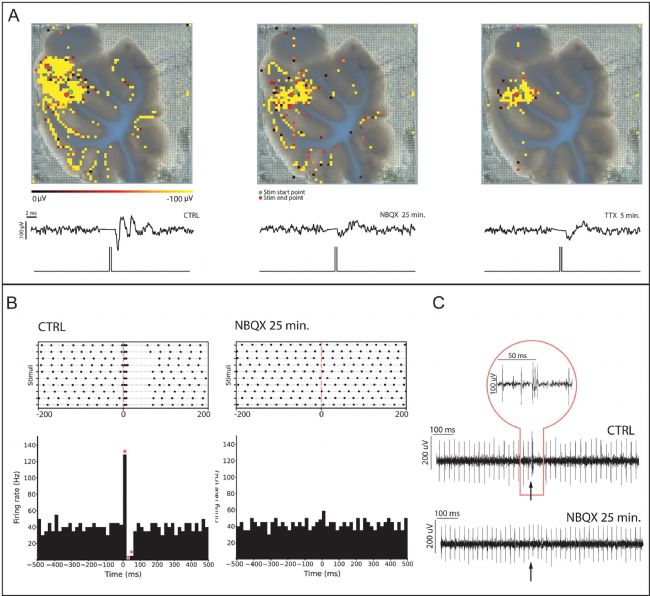 3Brain高分辨3D电极革新急性脑片、脑类器官及神经小球电生理记录