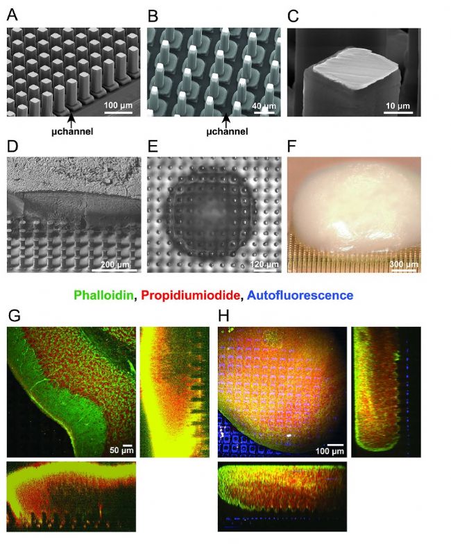 3Brain高分辨3D电极革新急性脑片、脑类器官及神经小球电生理记录