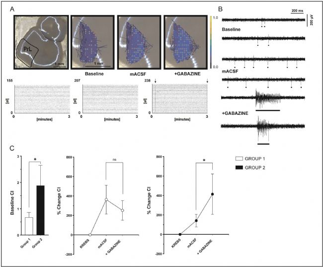3Brain高分辨3D电极革新急性脑片、脑类器官及神经小球电生理记录