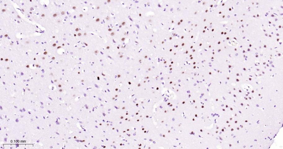 SATB2 Recombinant Rabbit mAb(b