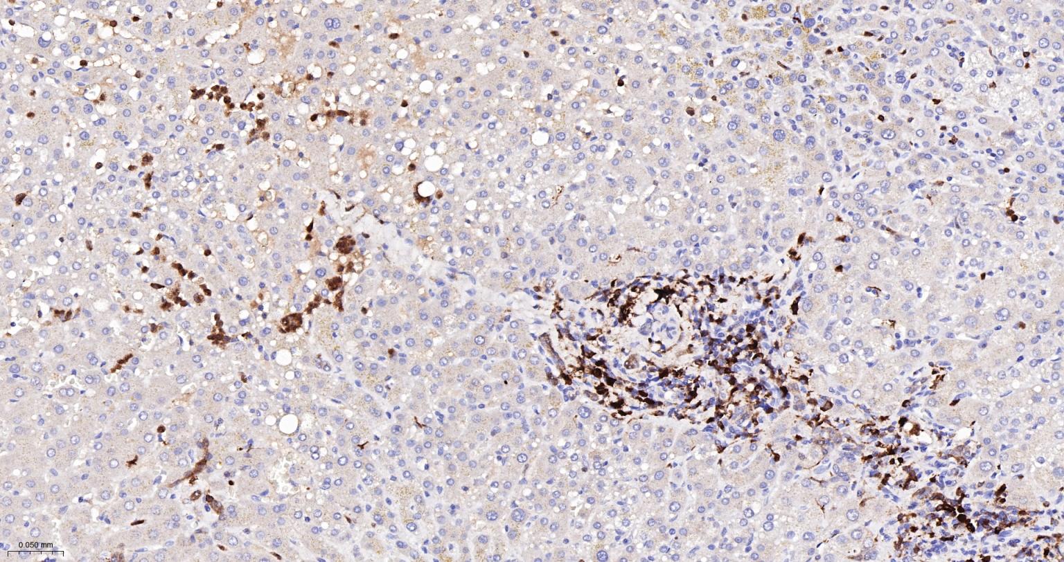 CD16 Recombinant Rabbit mAb(bs