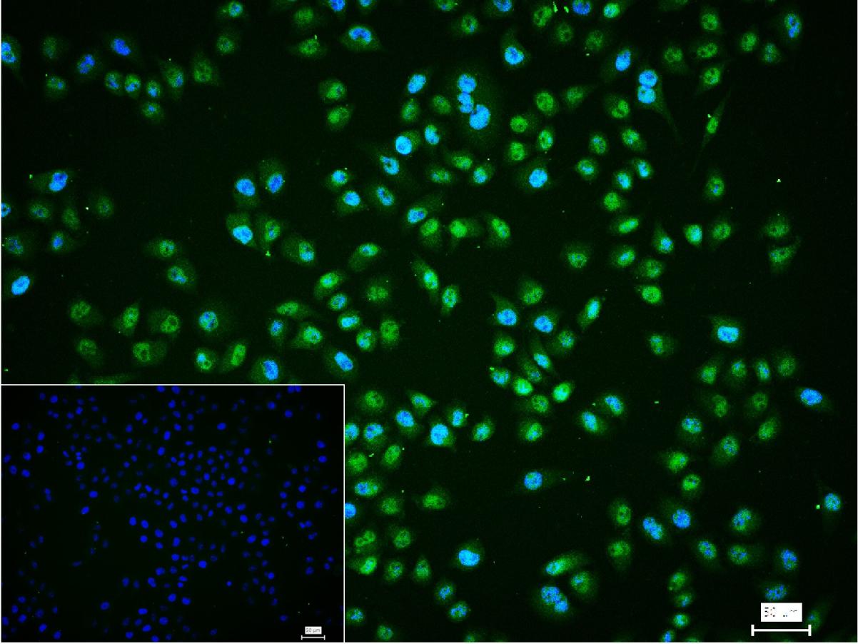 BRMS1 Recombinant Rabbit mAb(b