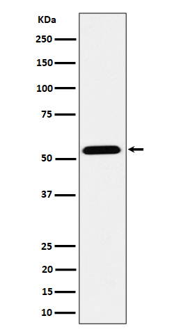 ENPP5 Recombinant Rabbit mAb(b