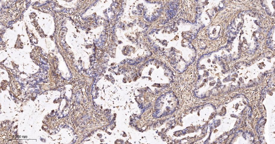 beta Actin Recombinant Rabbit 