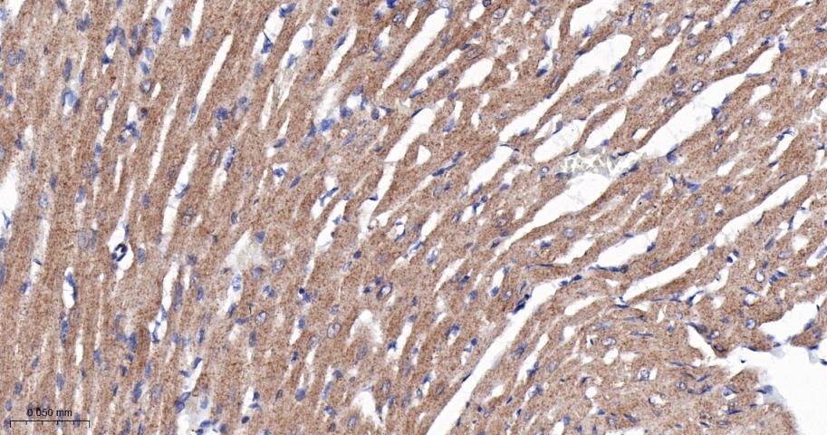 SERCA2 Recombinant Rabbit mAb(