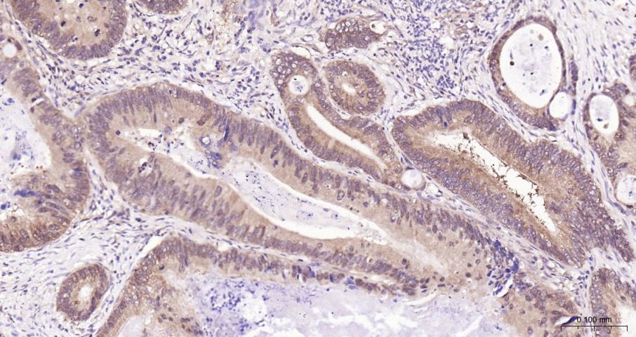 eIF4E Recombinant Rabbit mAb(b
