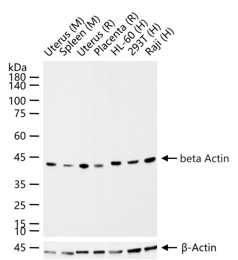 beta Actin Recombinant Rabbit 