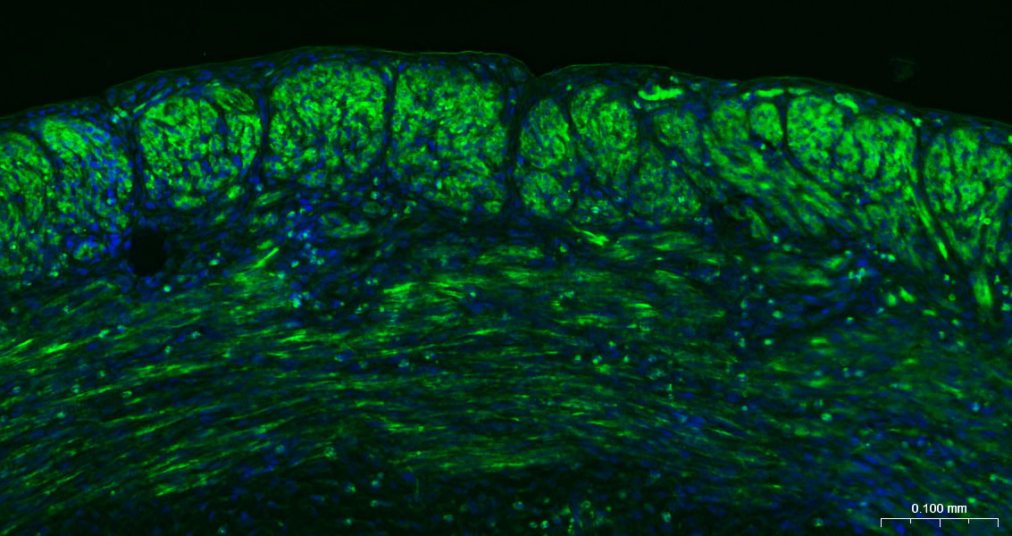 alpha smooth muscle Actin Mous