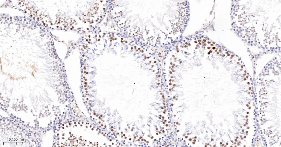 phospho-Histone H3 (S10) Recom