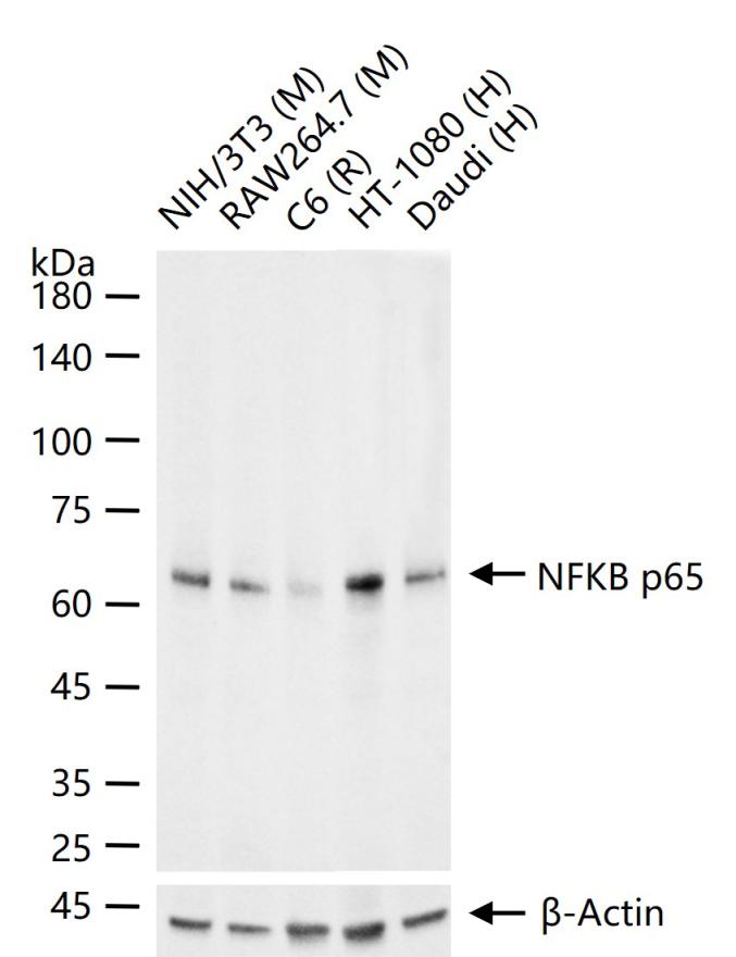 NFKB p65 Recombinant Rabbit mA