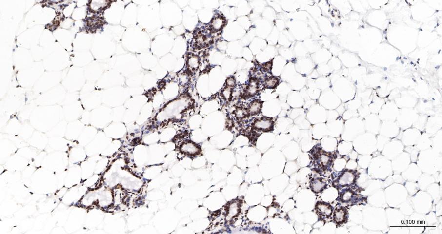 BRCA2 Rabbit pAb(bs-25812R)-50