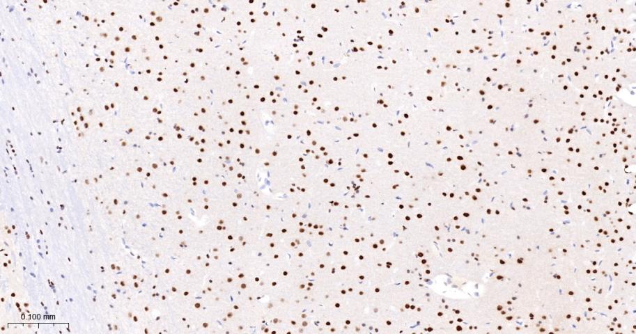 phospho-Histone H3 (S10) Recom