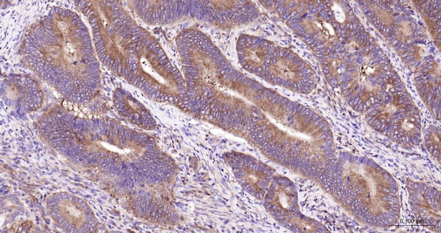 NFKB p65 Recombinant Rabbit mA