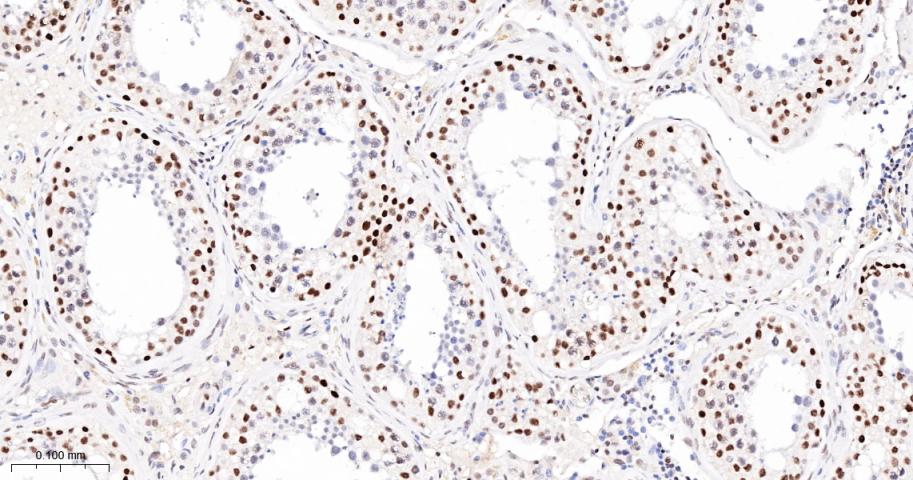 Oct-1 Recombinant Rabbit mAb(b