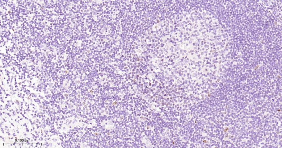 RCC1 Recombinant Rabbit mAb(bs