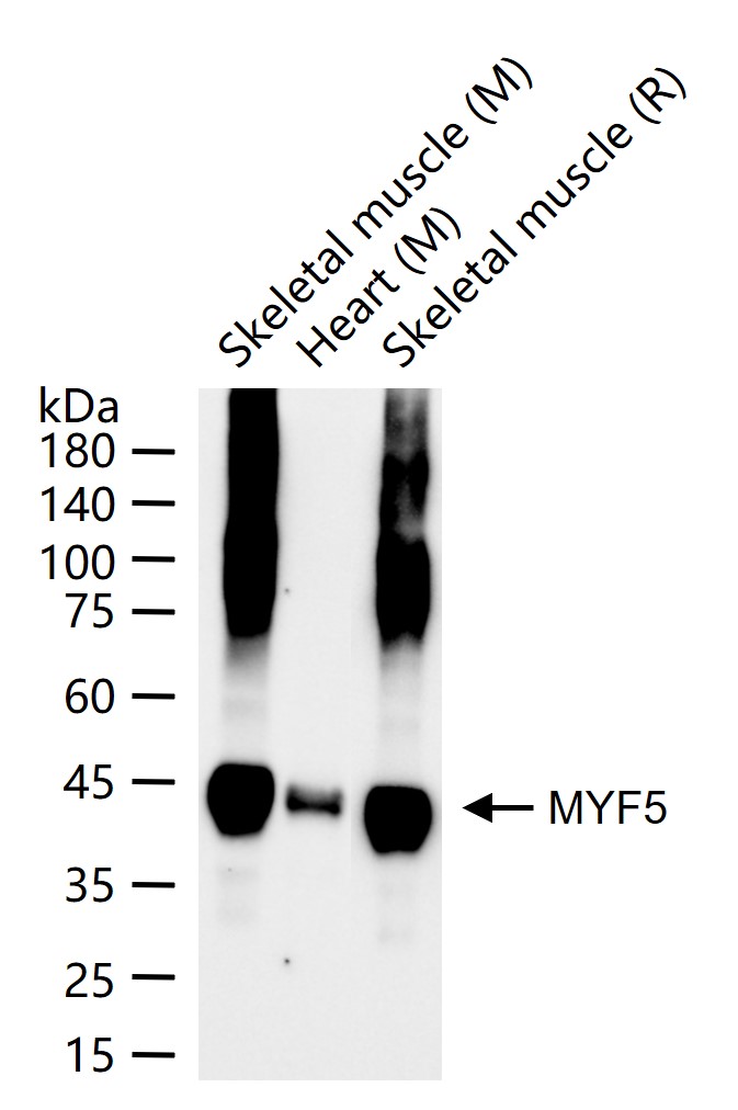 MYF5 Recombinant Rabbit mAb(bs