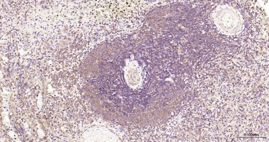 NFKB p65 Recombinant Rabbit mA