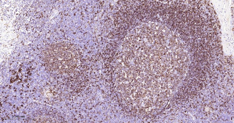 HLA-DRA Mouse mAb(bsm-51091M)-
