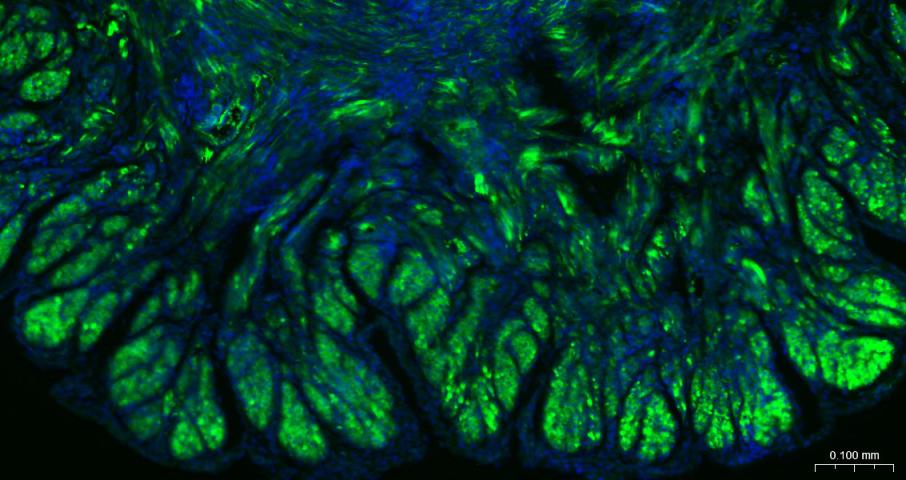 alpha smooth muscle Actin Mous