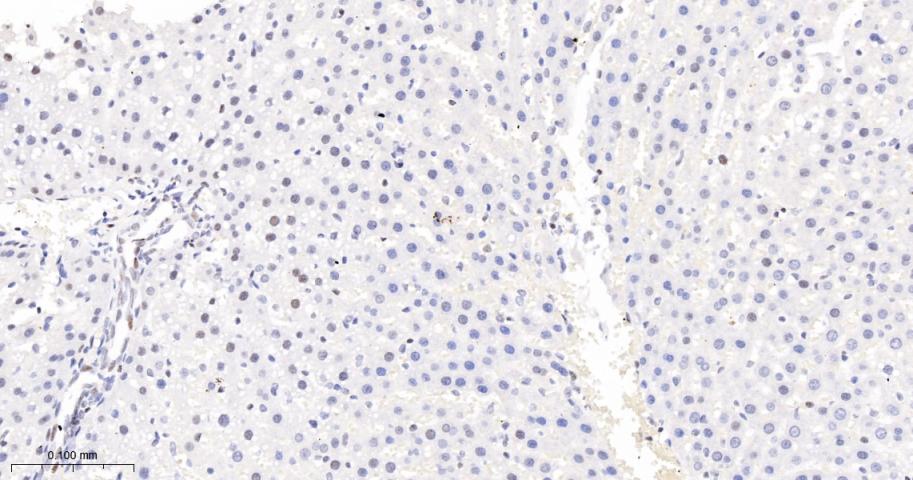 phospho-Histone H3 (S10) Recom