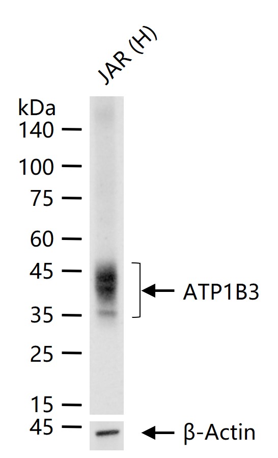 ATP1B3 Recombinant Rabbit mAb(