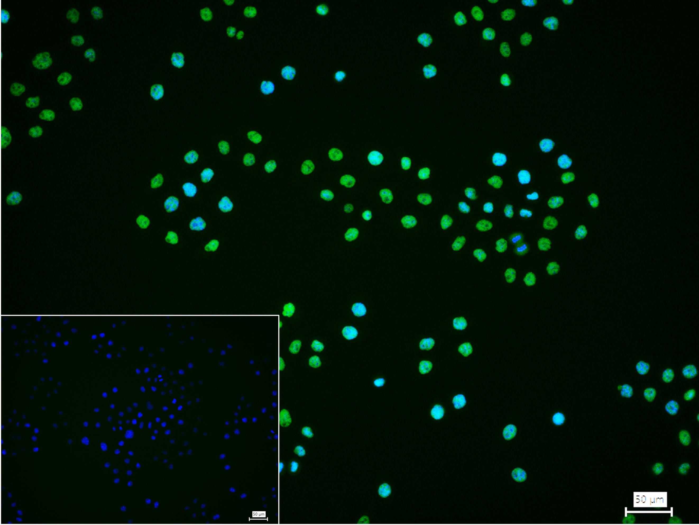 CTBP2 Recombinant Rabbit mAb(b