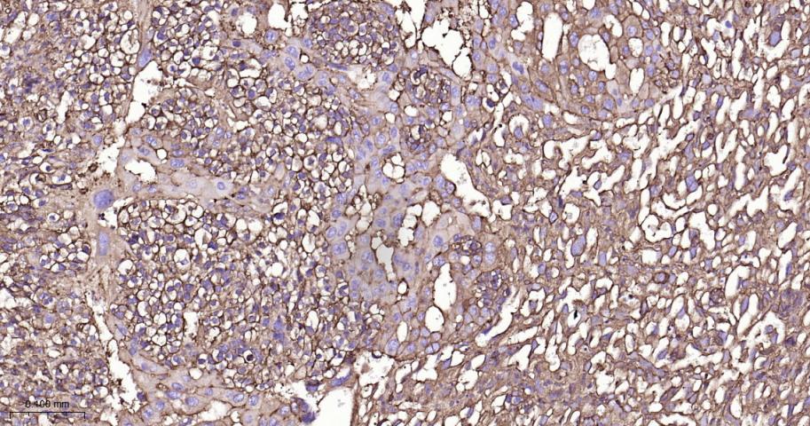 beta Actin Recombinant Rabbit 