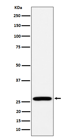 RPL13 Recombinant Rabbit mAb(b