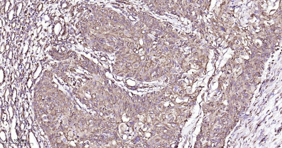 P4HB Recombinant Rabbit mAb(bs