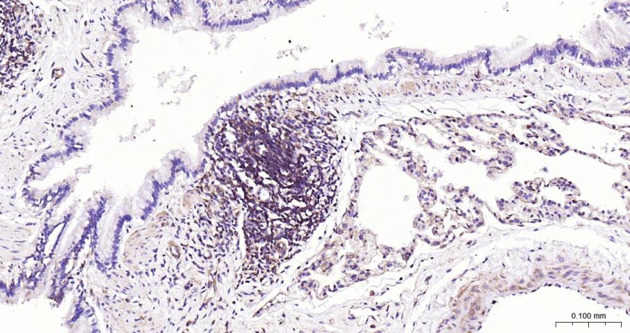 NFKB p65 Recombinant Rabbit mA