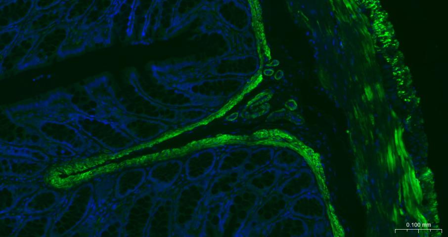 alpha smooth muscle Actin Mous