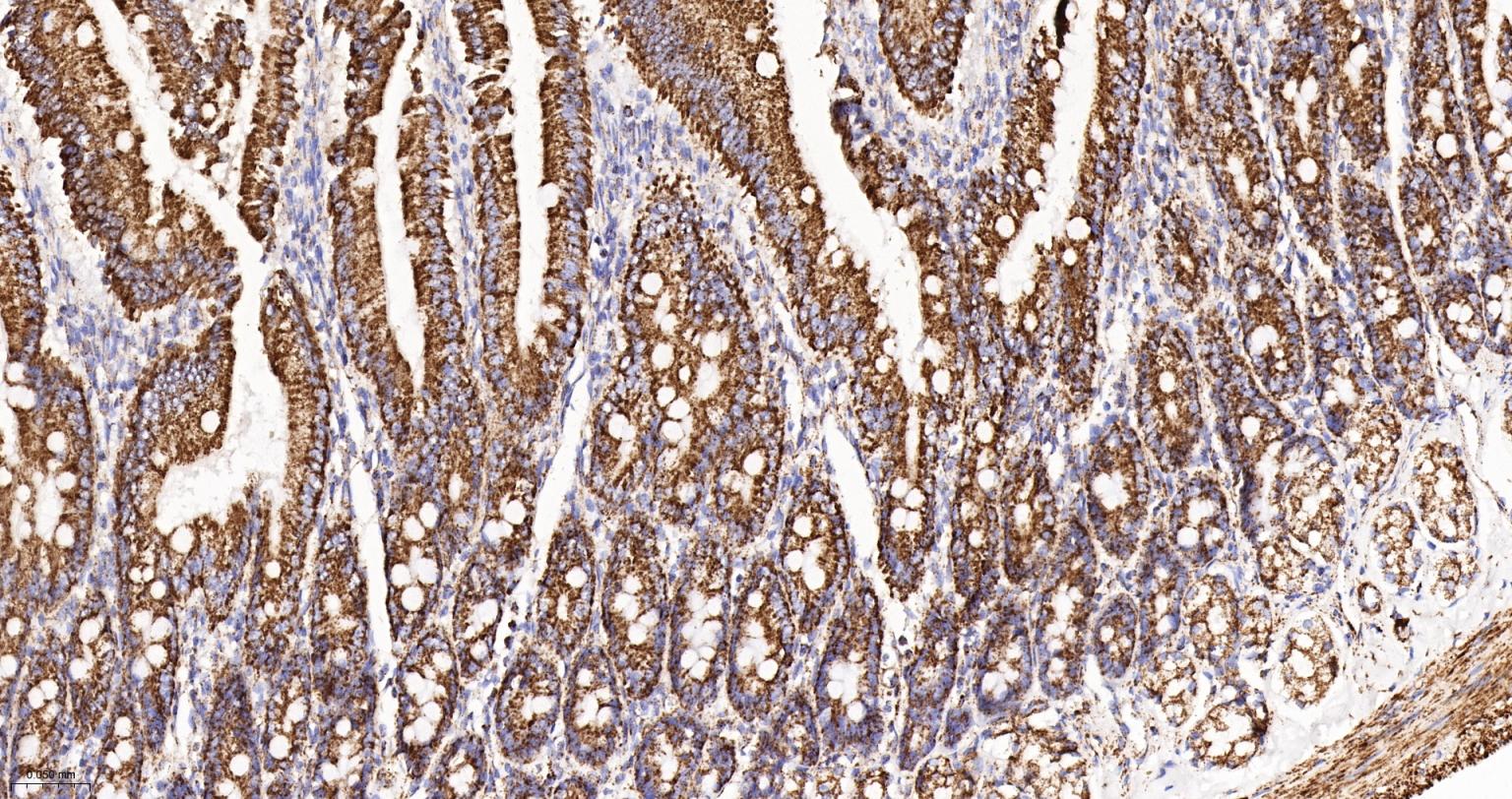 MDH2 Recombinant Rabbit mAb(bs