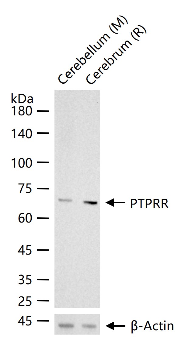 PTPRR Recombinant Rabbit mAb(b