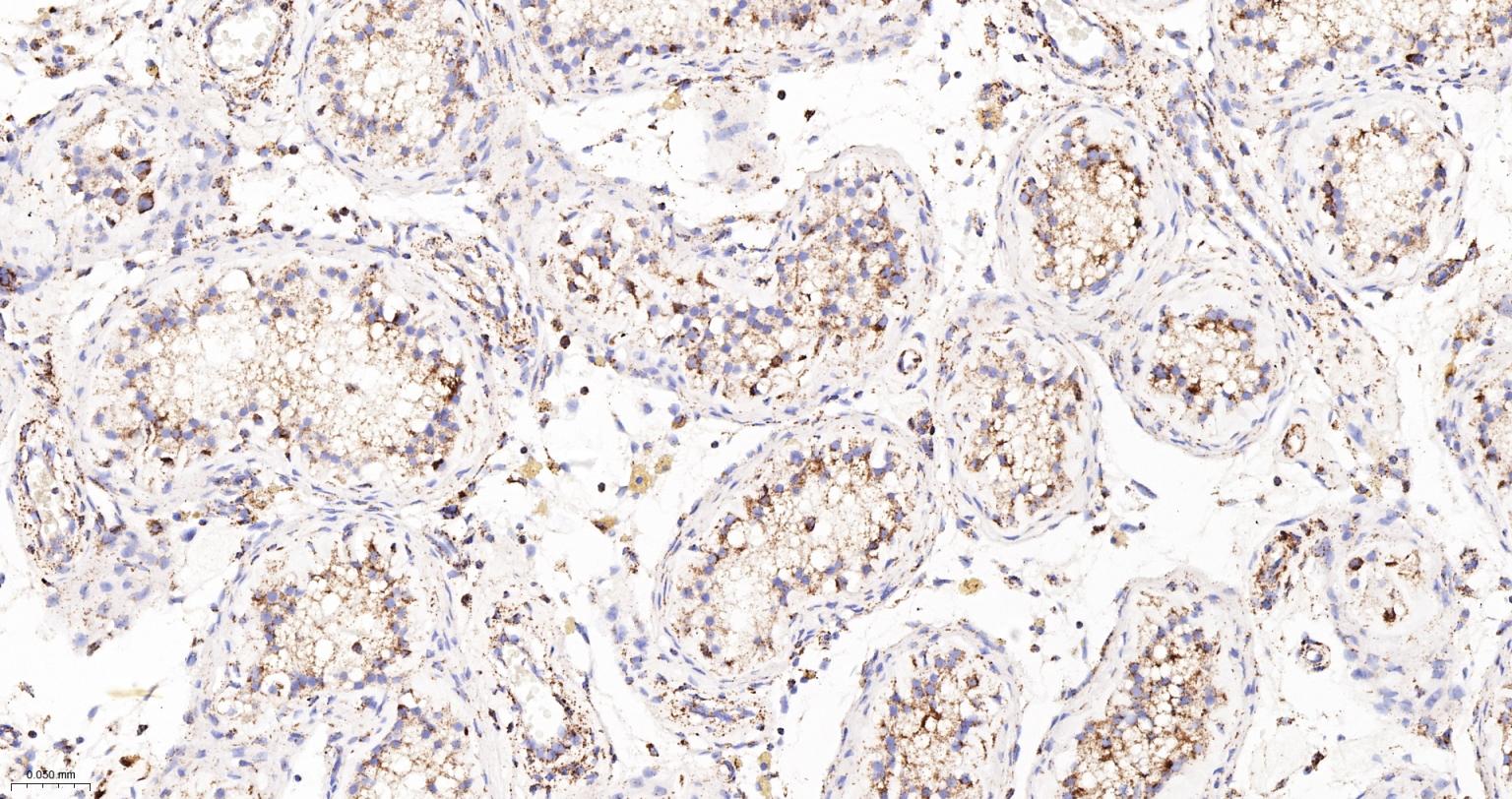 MDH2 Recombinant Rabbit mAb(bs