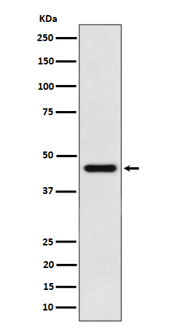 ACAT1 Recombinant Rabbit mAb(b