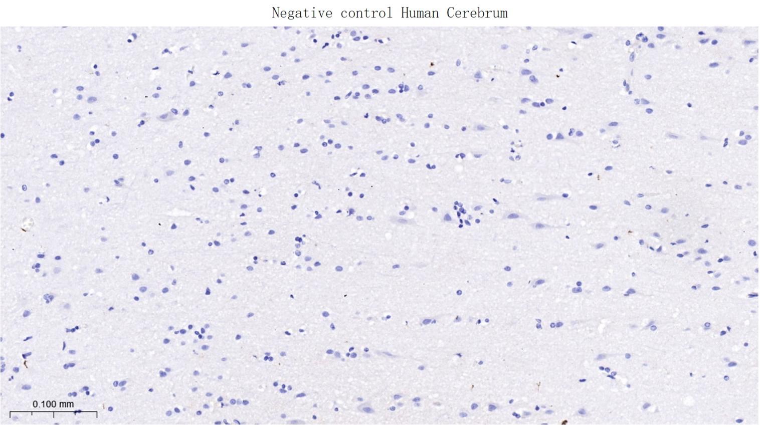 FTMT Recombinant Rabbit mAb(bs